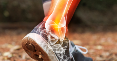 Muskelverletzungen: Prävention, Symptome und Behandlungen