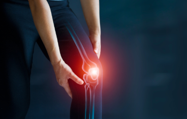 Artrosi del ginocchio