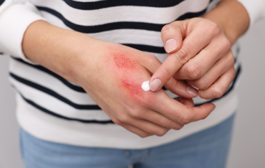 Guarigione delle ferite