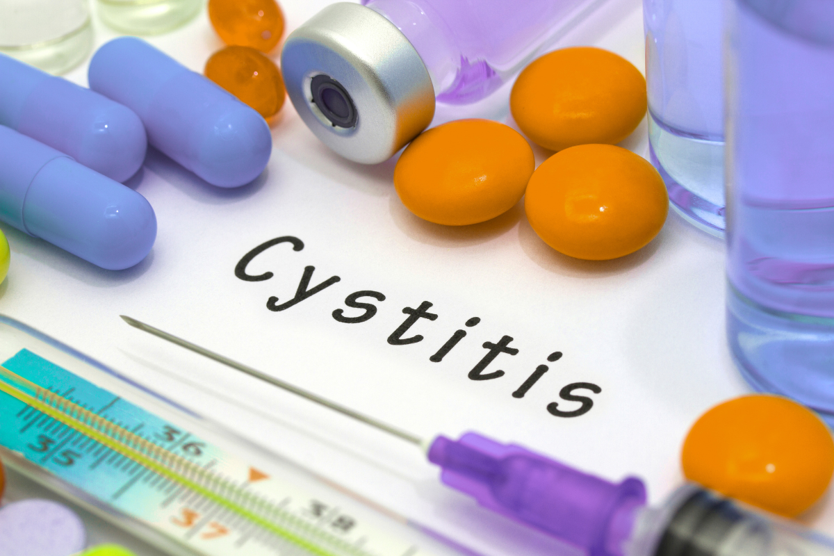 cistite-interstiziale-terapia-orale