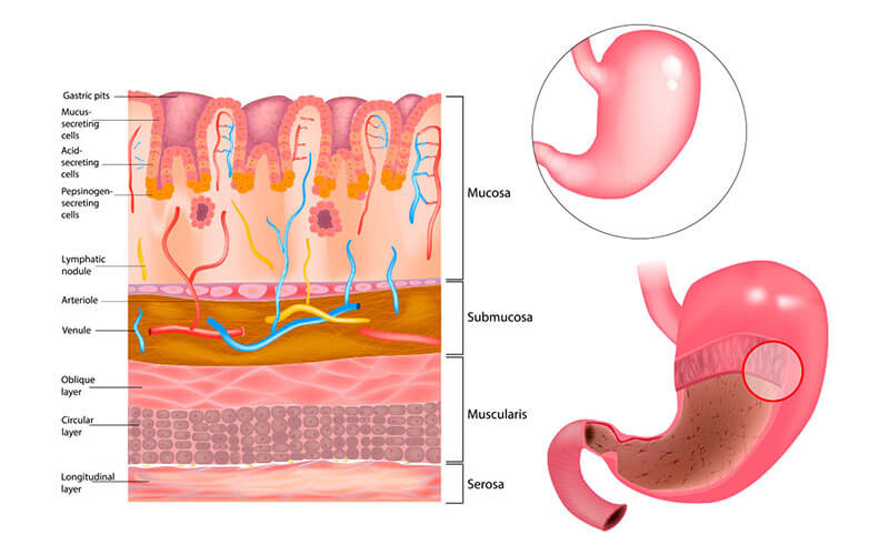 doloreacuto-trattamento-nolocalizzato-mucosa