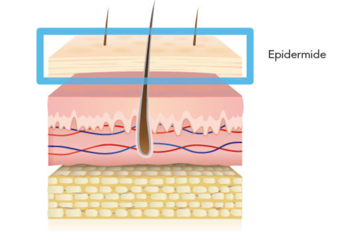 problemi-pelle-epidermide-it