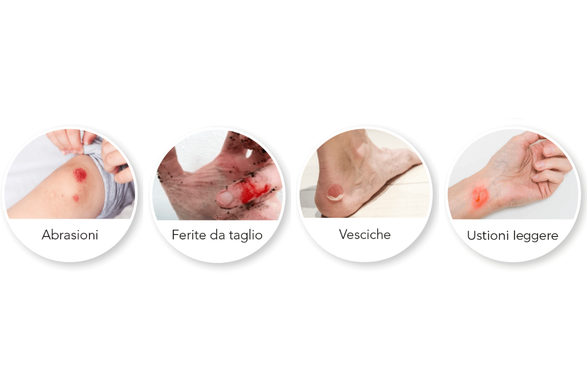ialpakut-ferite-tipologie-it