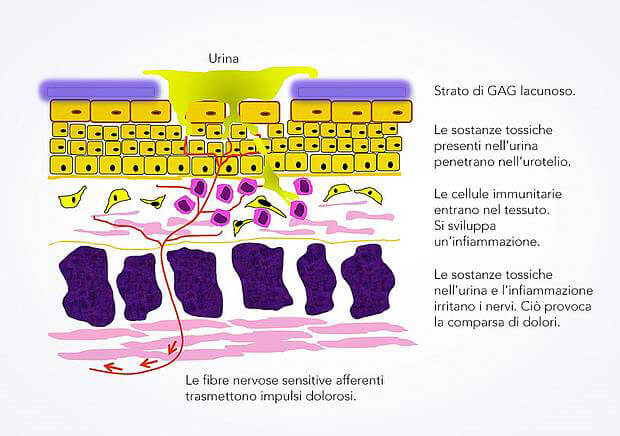csm_urothol_IT_c4c2a9192b