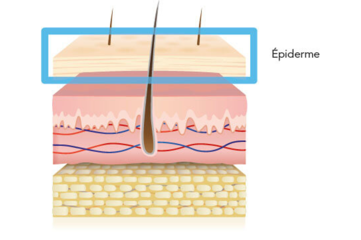 problemi-pelle-epidermide-fr