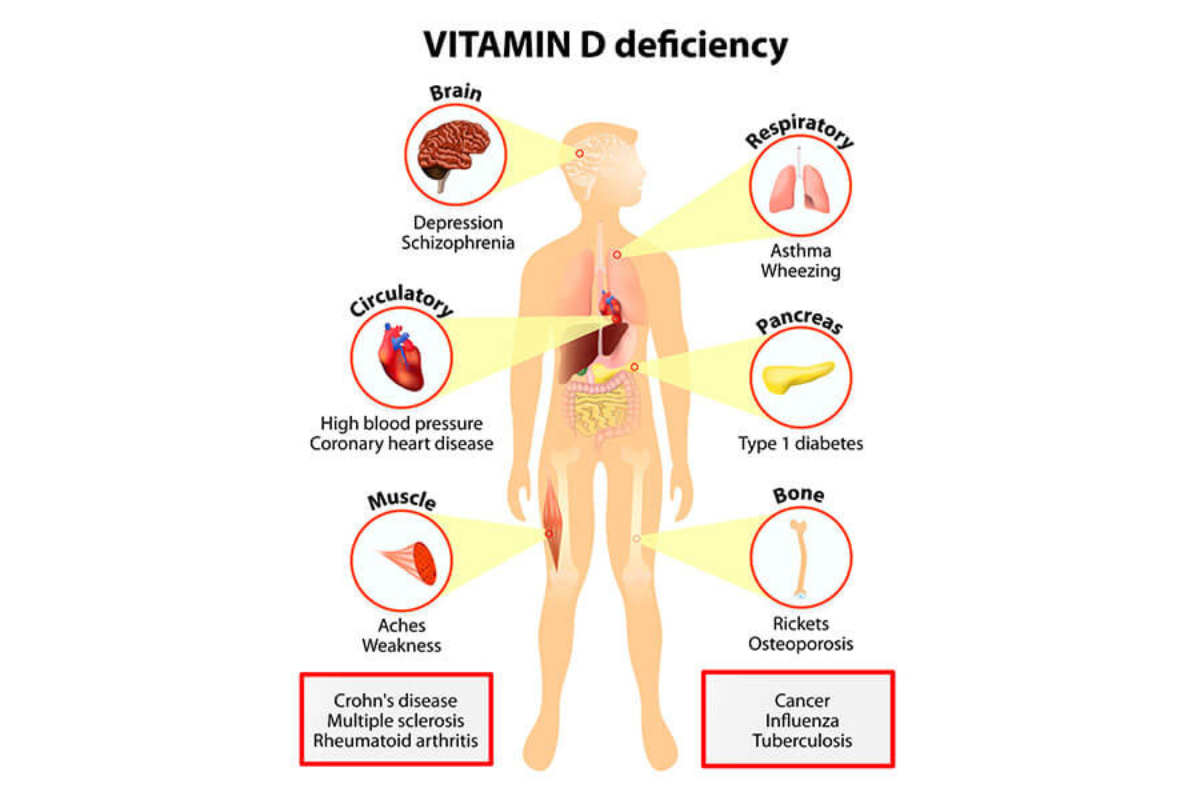 vitamine-minerali-vitaminad-salute-ossea-effetti