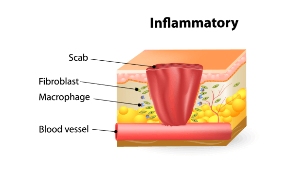 guarigioneferite-fasi-infiammatoria