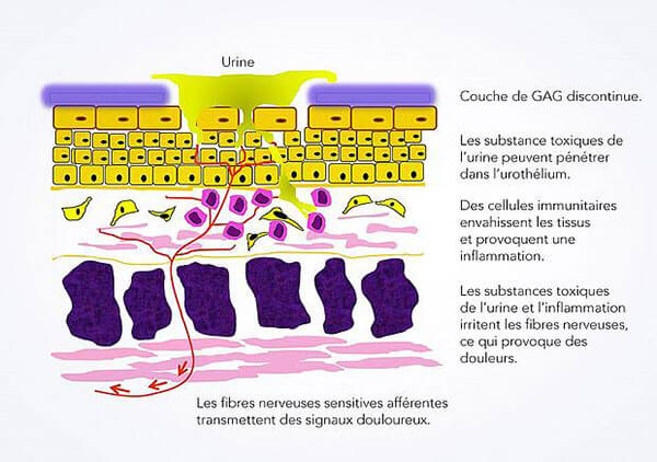 csm_urothol_FR