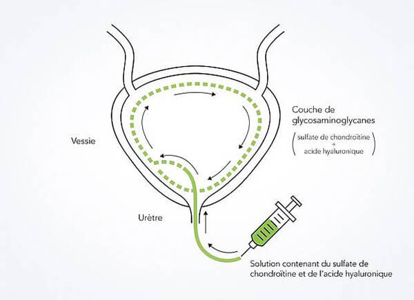 csm_Glykosaminoglykanschicht_FR_ef9efe009a