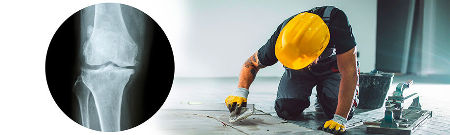 artrosi-patologia-processo-formazione-osteofiti