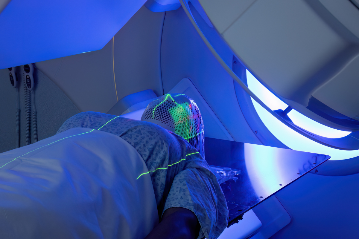 cistite-attinica-radioterapia